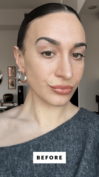 Wohlner before applying the Refy Concealer